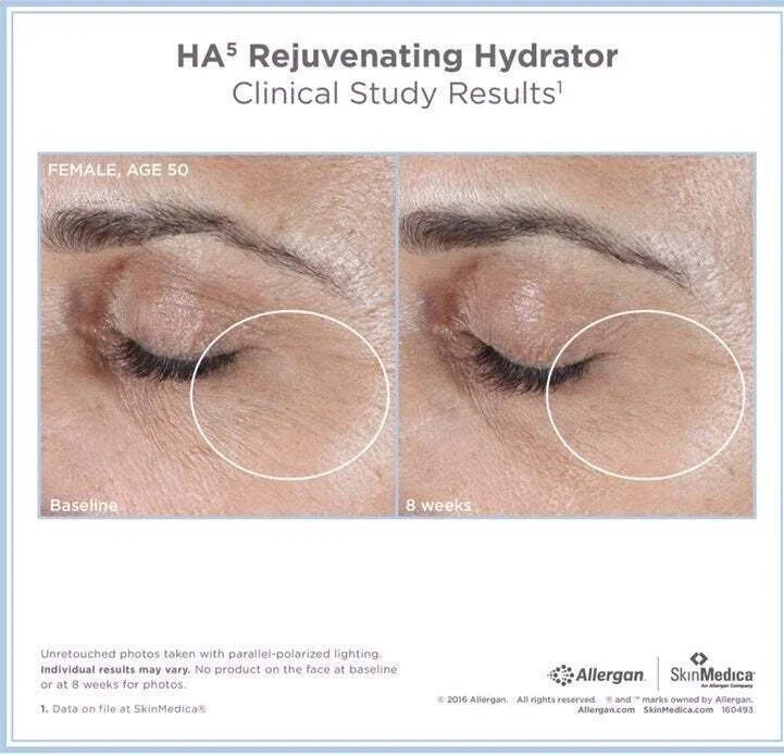 SkinMedica HA5 Rejuvenating Hydrator – 2 oz | Hyaluronic Acid Moisturizer | Brand New Sealed